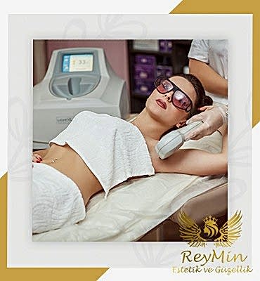 Buz Lazer Epilasyon Samsun