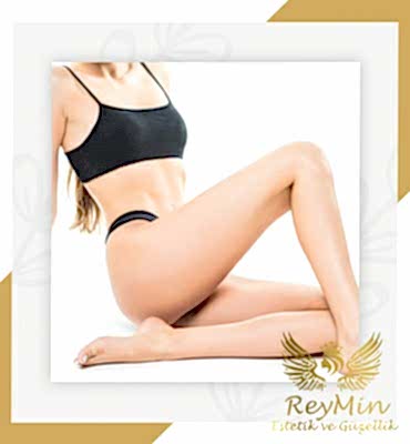 İğneli Epilasyon Samsun