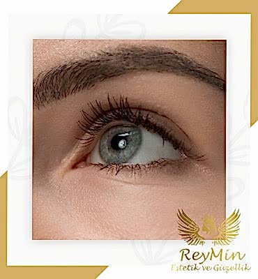 Kaş Silme Samsun